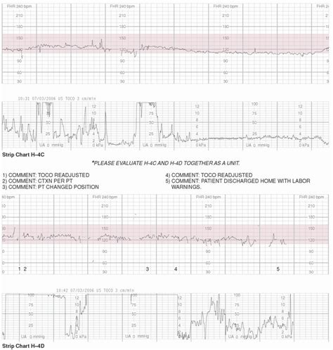 Exercises in Electronic Fetal Monitoring .